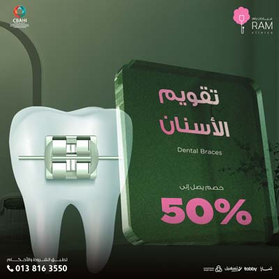 خصم يصل الى 50% على تقويم الأسنان