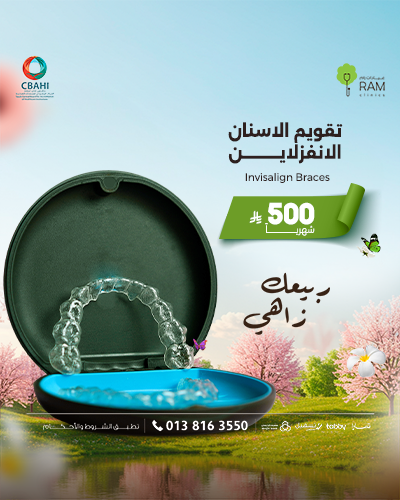 تقويم الاسنان الانفزلاين بأقساط شهرية