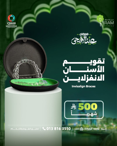 تقويم الاسنان الانفزلاين بأقساط شهرية