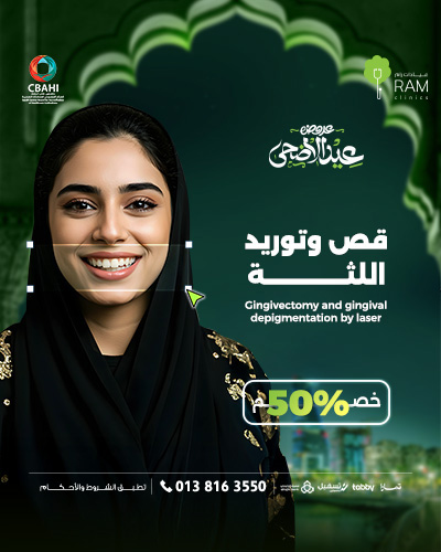 خصم 50% على قص وتوريد اللثة