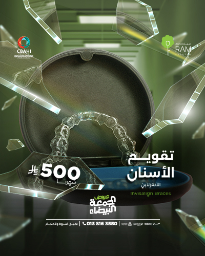 تقويم الاسنان الانفزلاين بأقساط شهرية