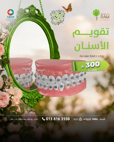 تقويم الاسنان بأقساط شهرية