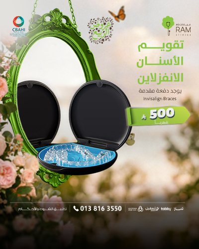 تقويم الاسنان الانفزلاين بأقساط شهرية