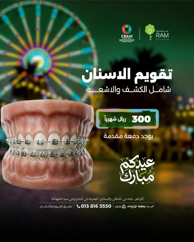 تقويم الاسنان بأقساط شهرية