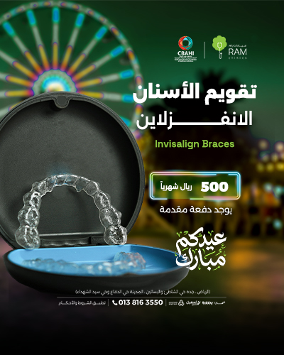 تقويم الاسنان الانفزلاين بأقساط شهرية