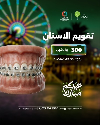 تقويم الاسنان بأقساط شهرية