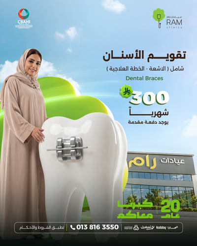 تقويم الاسنان بأقساط شهرية