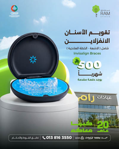 تقويم الاسنان الانفزلاين بأقساط شهرية
