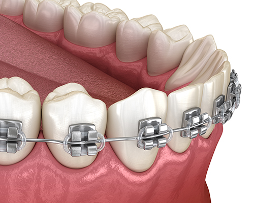orthodontics