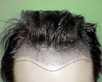 رسم خط مقدمة الشعر